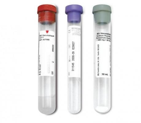 Κιτρικό άλας νατρίου αντιπηκτικών   Σωλήνες συλλογής αίματος οδηγών χρώματος φθοριδίου νατρίου προμηθευτής